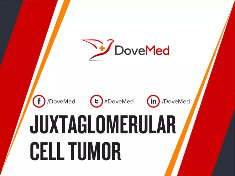 Can you access healthcare professionals in your community to manage Juxtaglomerular Cell Tumor?