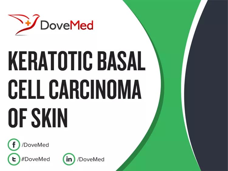 Is the cost to manage Keratotic Basal Cell Carcinoma of Skin in your community affordable?