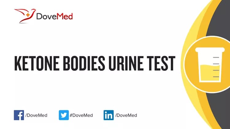 Ketone Bodies Urine Test