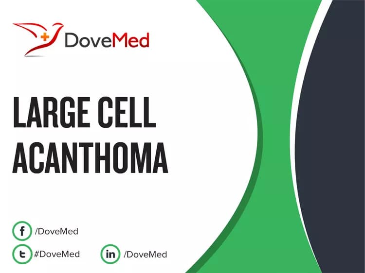 Is the cost to manage Large Cell Acanthoma in your community affordable?