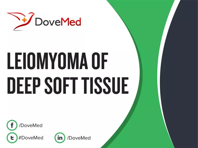 Is the cost to manage Leiomyoma of Deep Soft Tissue in your community affordable?