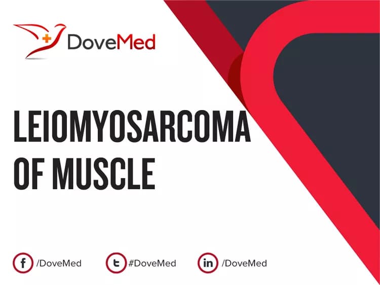 Can you access healthcare professionals in your community to manage Leiomyosarcoma of Muscle?
