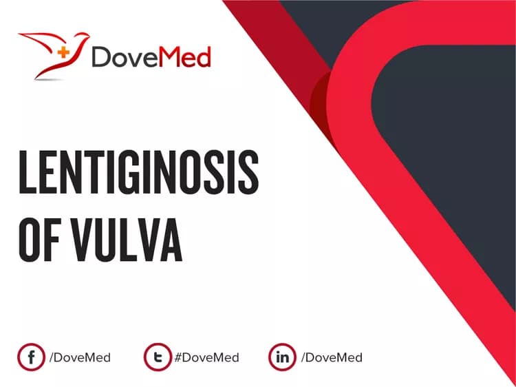 Can you access healthcare professionals in your community to manage Lentiginosis of Vulva?