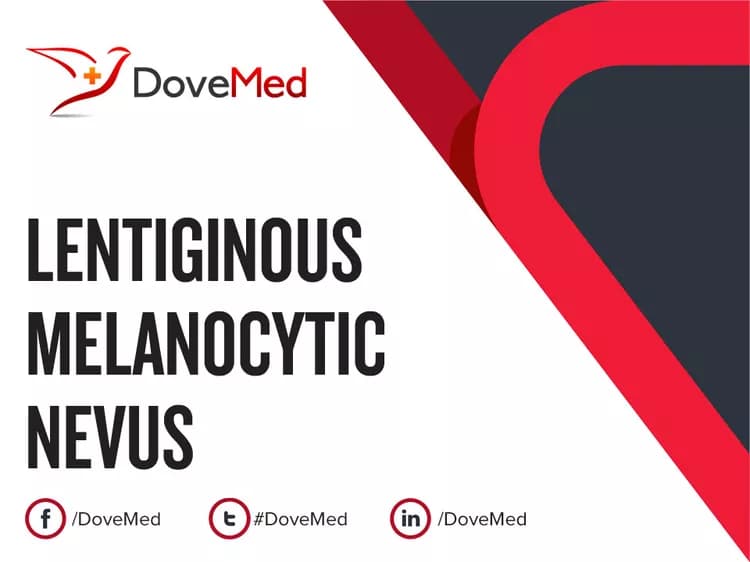 Can you access healthcare professionals in your community to manage Lentiginous Melanocytic Nevus?