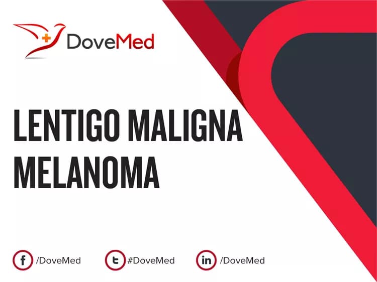 Can you access healthcare professionals in your community to manage Lentigo Maligna Melanoma?