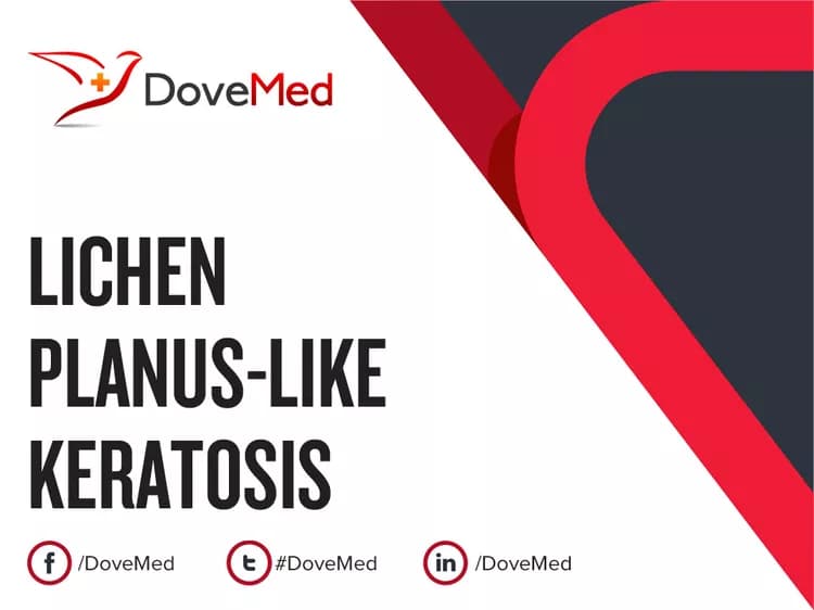 Can you access healthcare professionals in your community to manage Lichen Planus-like Keratosis?