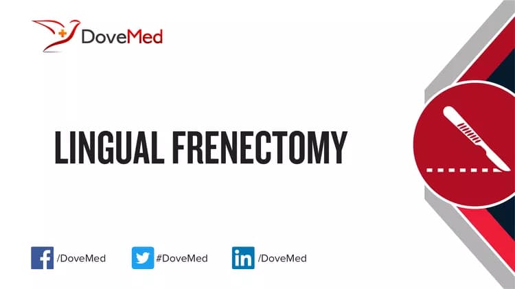 Lingual Frenectomy