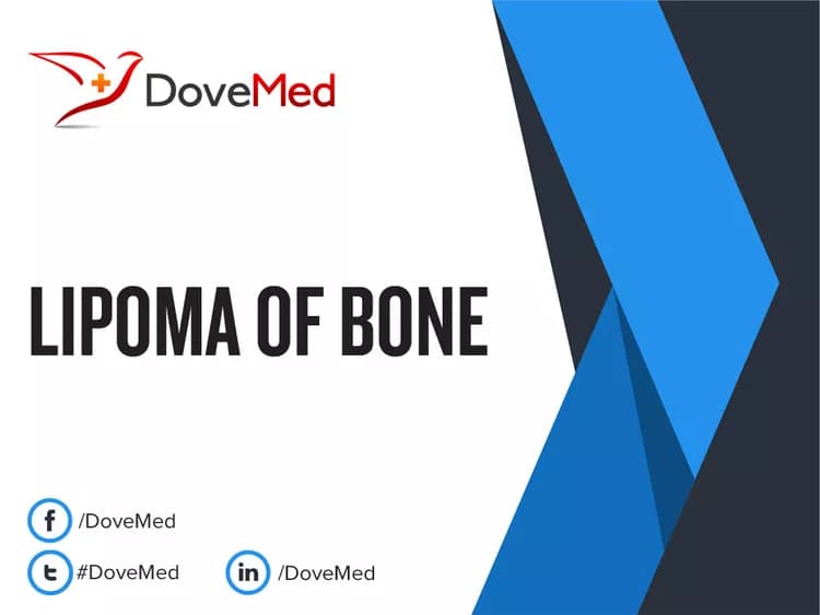 Can you access healthcare professionals in your community to manage Lipoma of Bone?