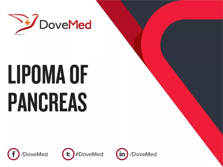 Can you access healthcare professionals in your community to manage Lipoma of Pancreas?