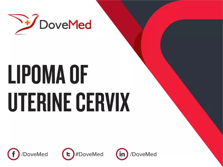Are you satisfied with the quality of care to manage Lipoma of Uterine Cervix in your community?
