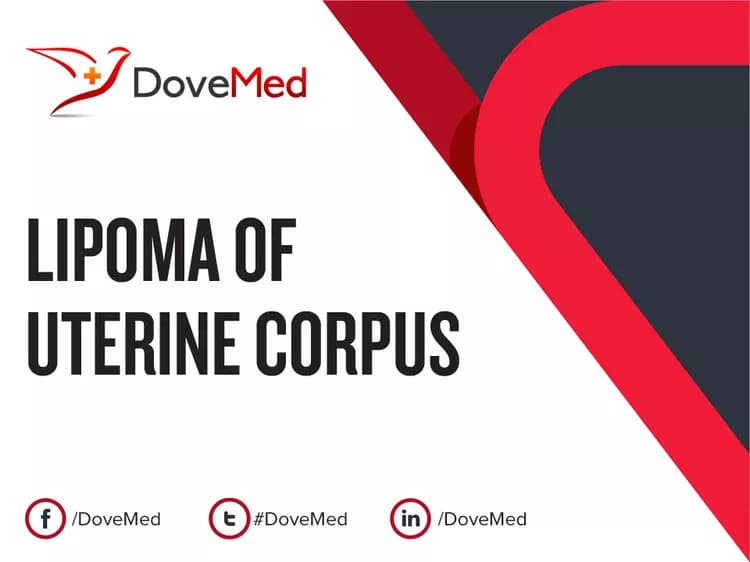 Can you access healthcare professionals in your community to manage Lipoma of Uterine Corpus?