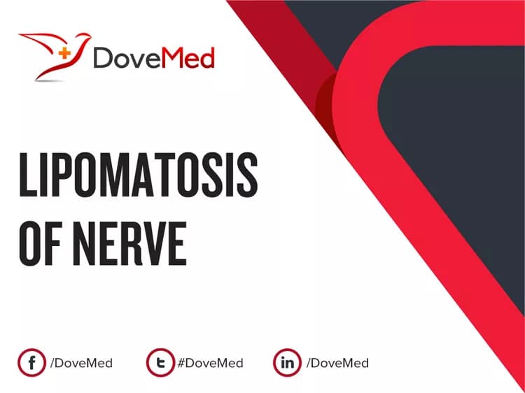Can you access healthcare professionals in your community to manage Lipomatosis of Nerve?