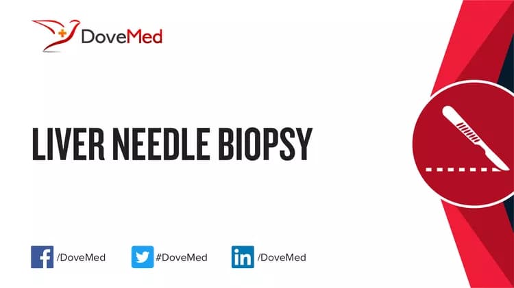 Liver Needle Biopsy