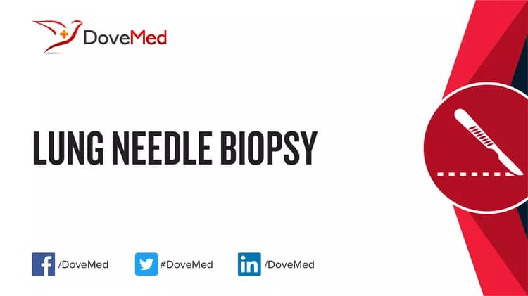 Lung Needle Biopsy