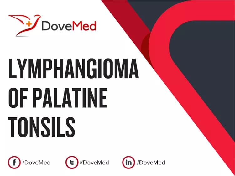 Lymphangioma of Palatine Tonsils