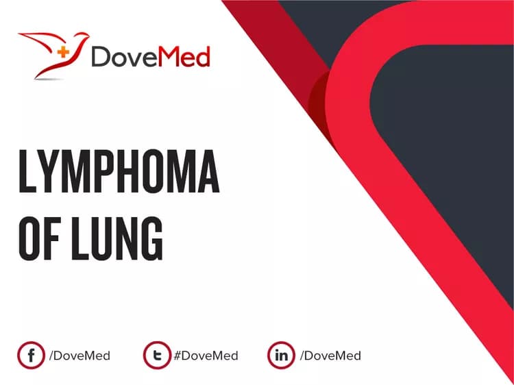 Can you access healthcare professionals in your community to manage Lymphoma of Lung?