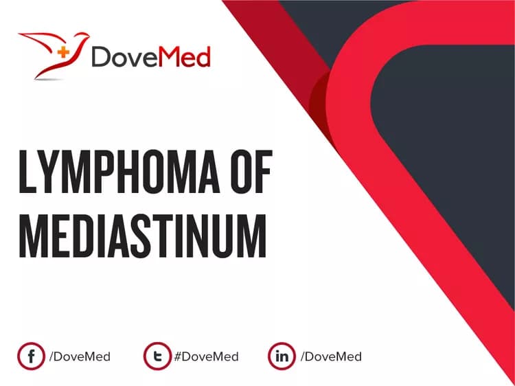 Can you access healthcare professionals in your community to manage Lymphoma of Mediastinum?