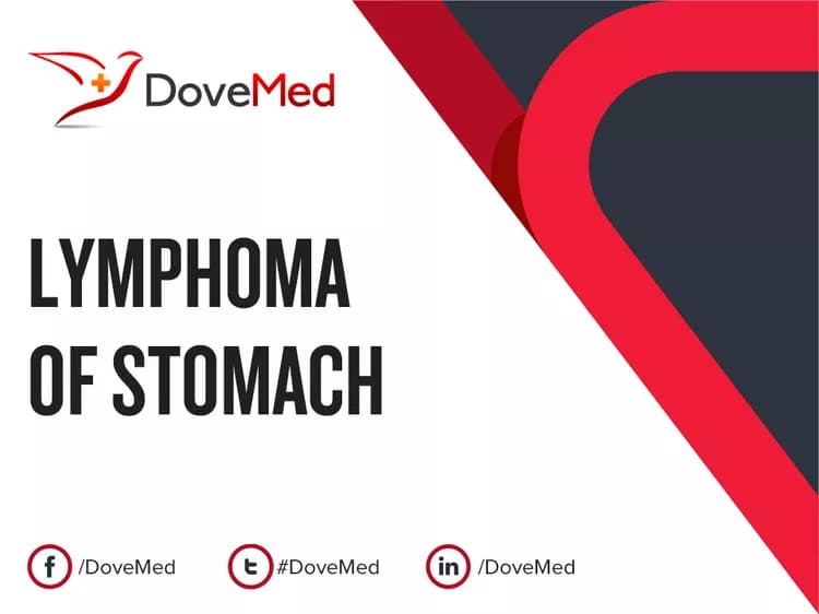 Can you access healthcare professionals in your community to manage Lymphoma of Stomach?
