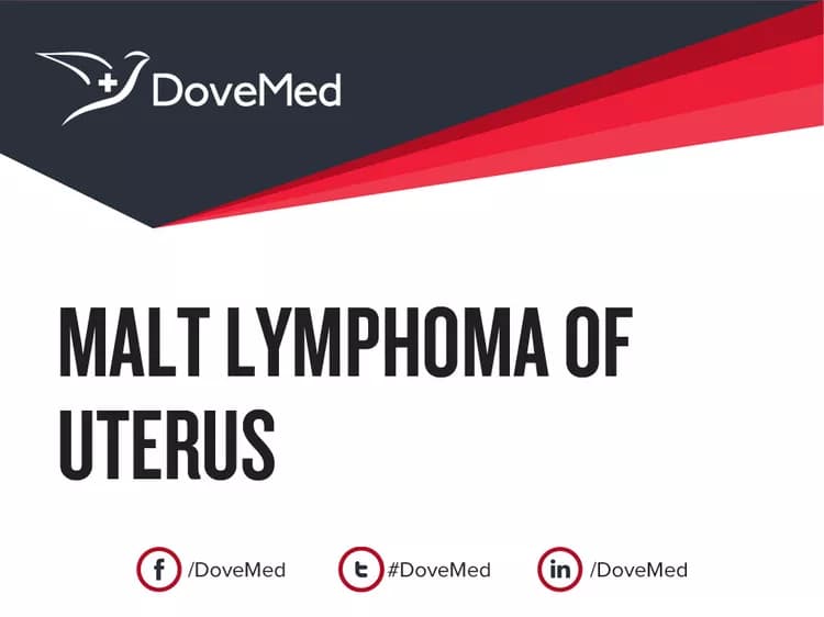 Are you satisfied with the quality of care to manage MALT Lymphoma of Uterus in your community?