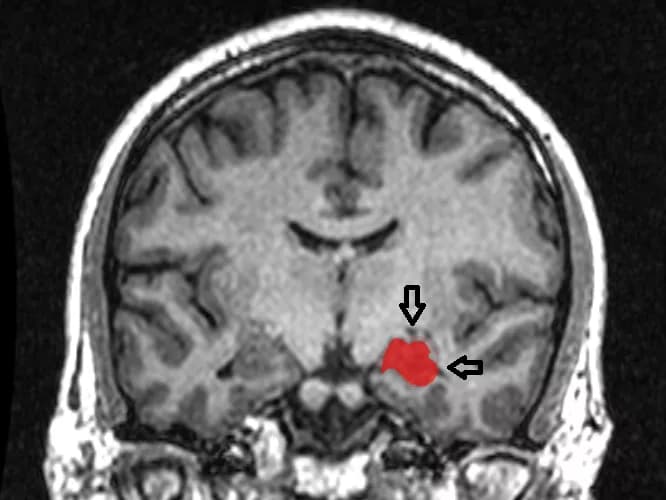 Amber Rieder, Jenna Traynor