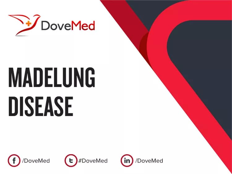 Madelung Disease