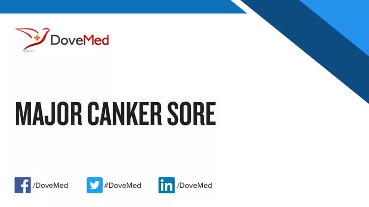 Can you access healthcare professionals in your community to manage Major Canker Sore?