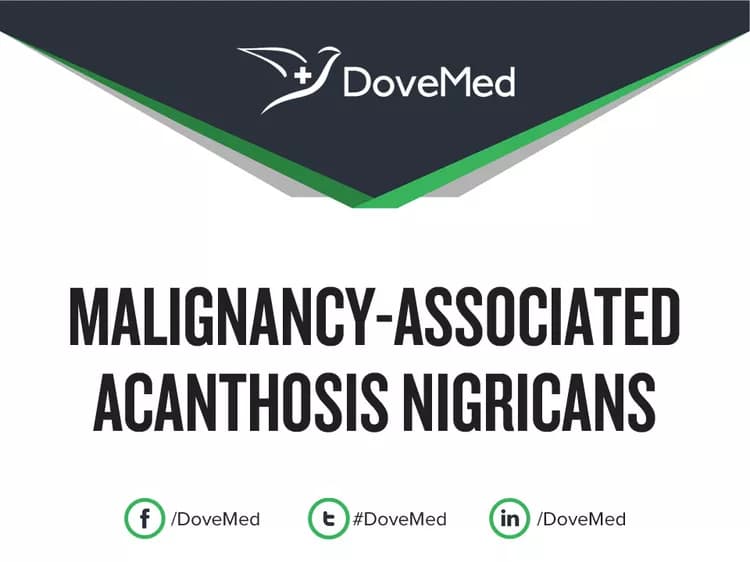 Can you access healthcare professionals in your community to manage Malignancy-Associated Acanthosis Nigricans?