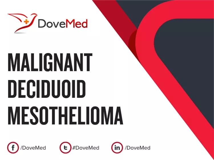 Can you access healthcare professionals in your community to manage Malignant Deciduoid Mesothelioma?
