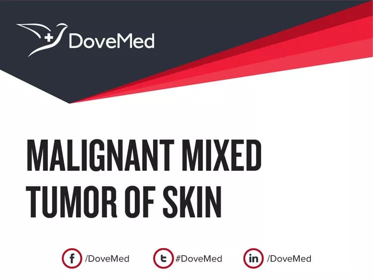 Malignant Mixed Tumor of Skin
