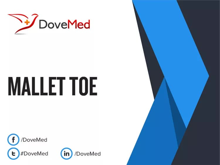 Can you access healthcare professionals in your community to manage Mallet Toe?