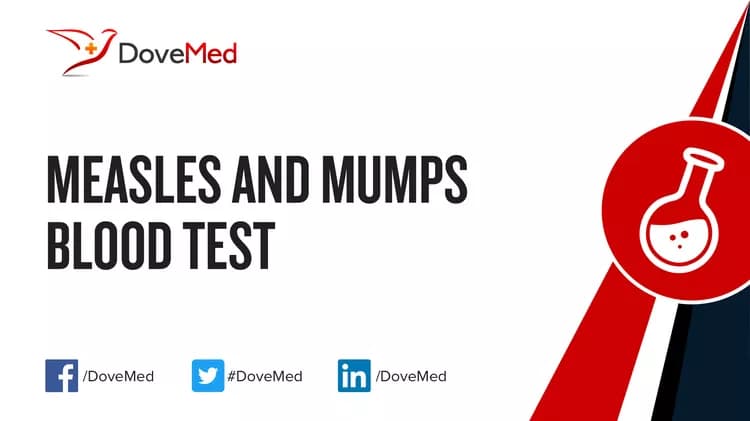 Measles and Mumps Blood Test