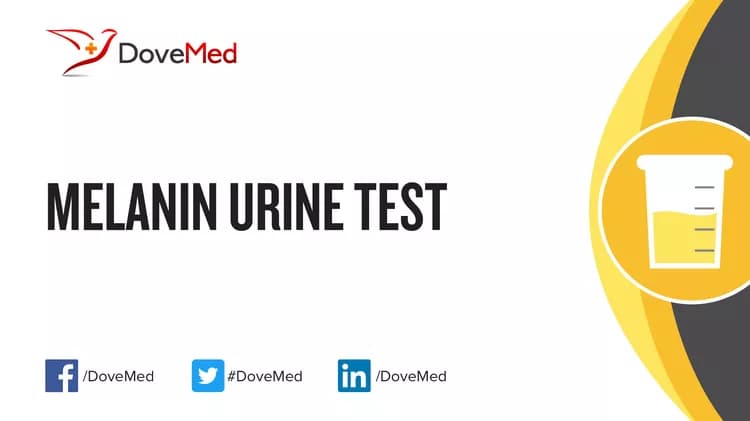 Melanin Urine Test