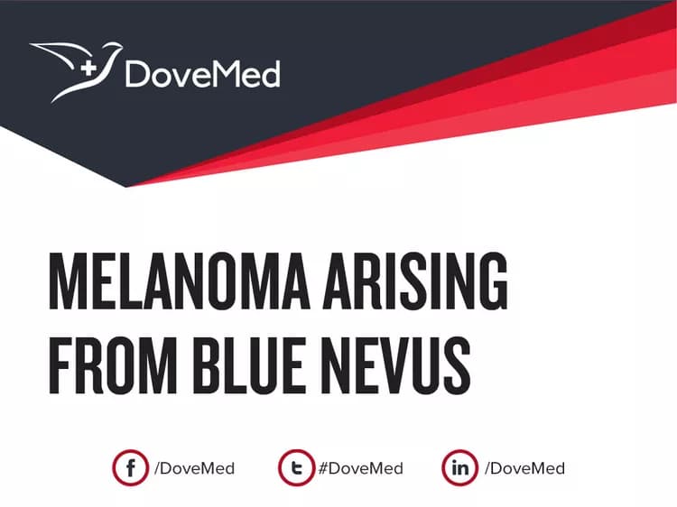 Melanoma arising from Blue Nevus
