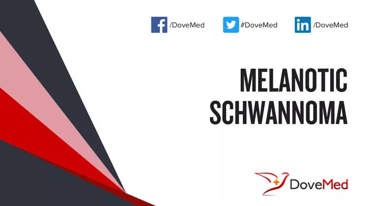 Is the cost to manage Melanotic Schwannoma in your community affordable?