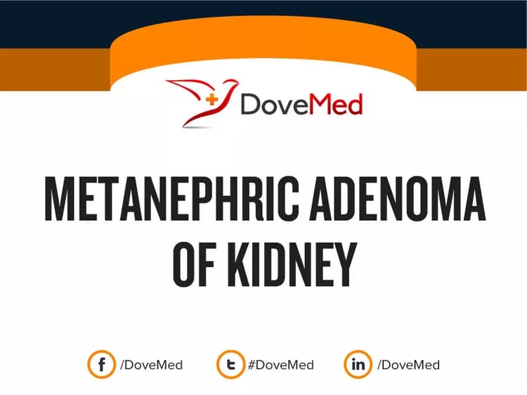 Is the cost to manage Metanephric Adenoma of Kidney in your community affordable?