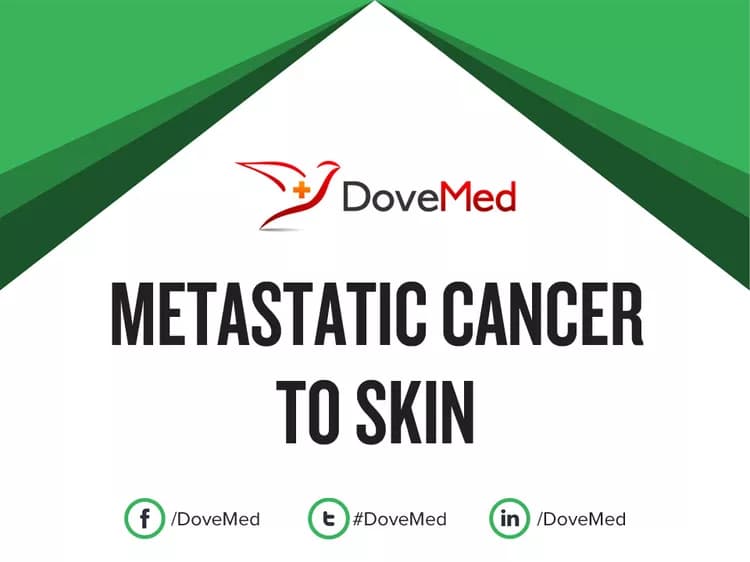 How well do you know Metastatic Cancer to Skin?