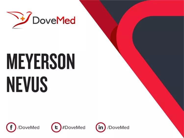 Can you access healthcare professionals in your community to manage Meyerson Nevus?
