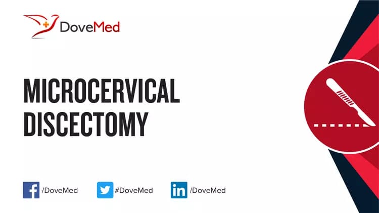 Microcervical Discectomy (MCD)