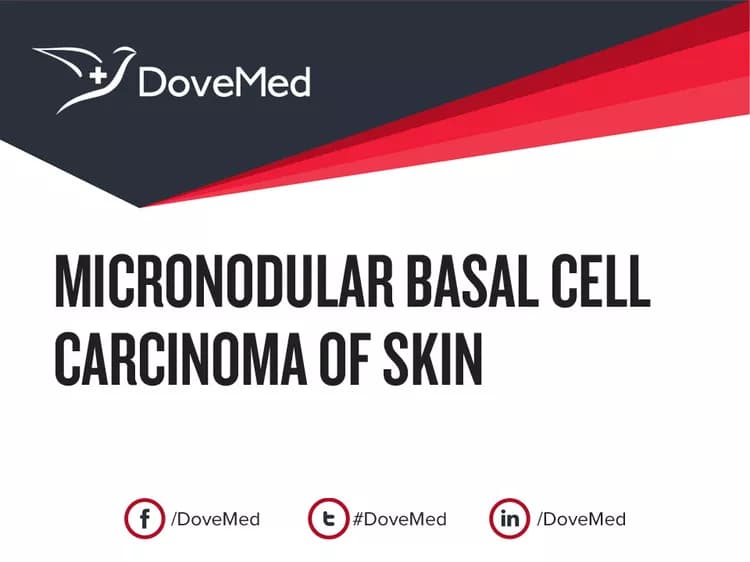 Micronodular Basal Cell Carcinoma of Skin
