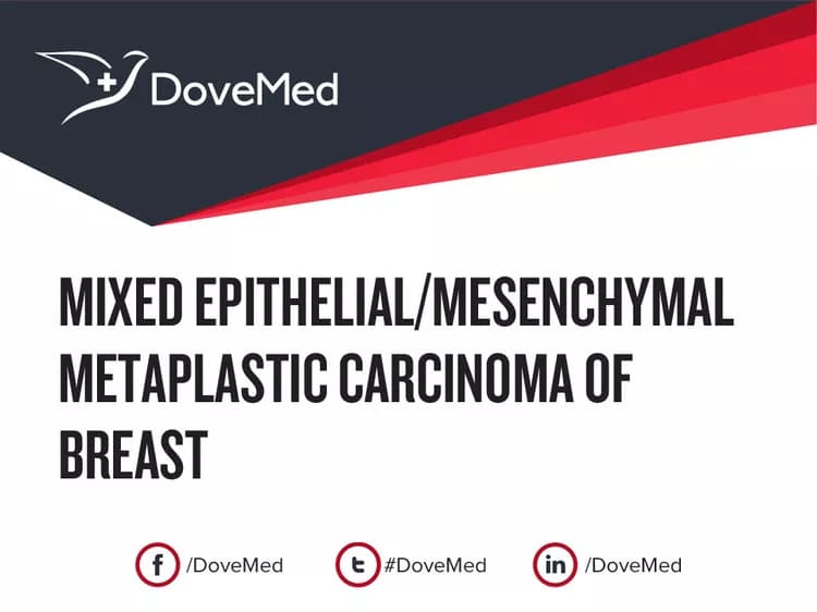 Mixed Epithelial/Mesenchymal Metaplastic Carcinoma of Breast