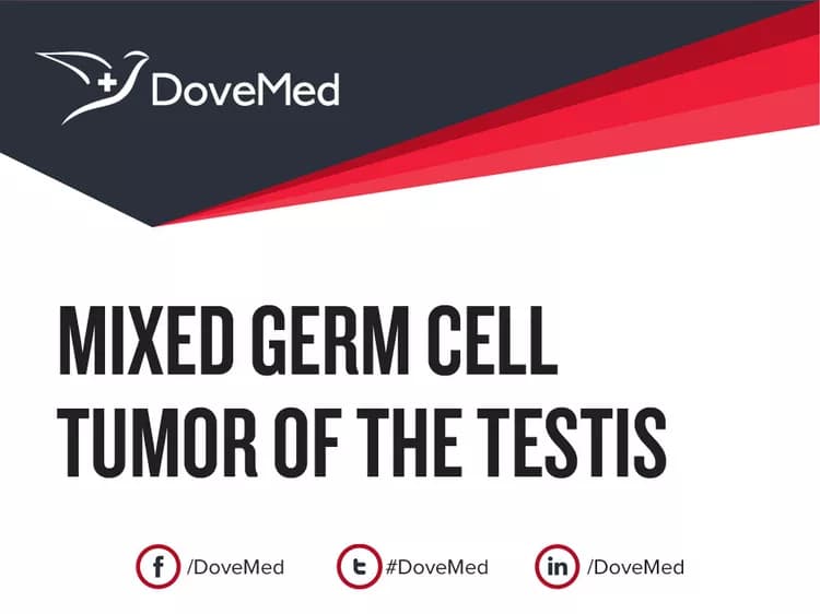 Can you access healthcare professionals in your community to manage Mixed Germ Cell Tumor of the Testis?