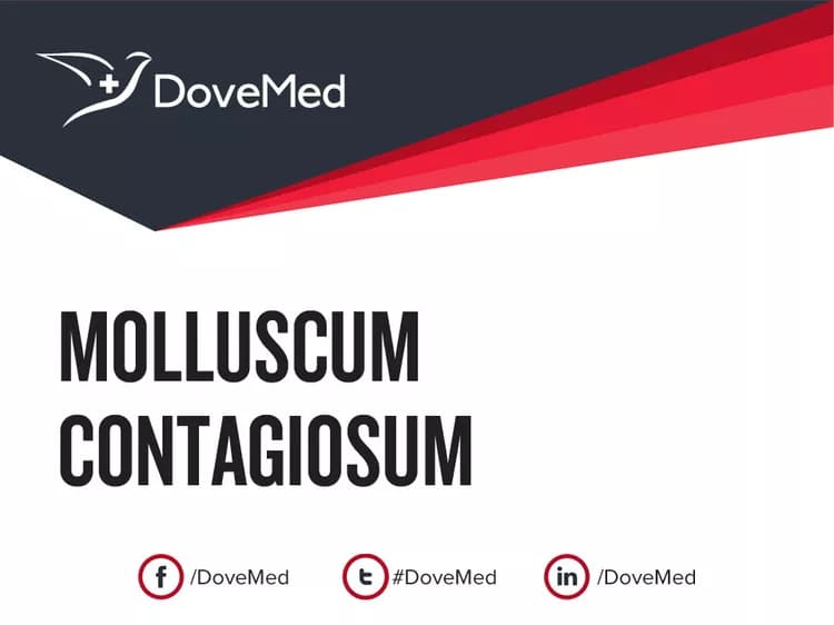 Can you access healthcare professionals in your community to manage Molluscum Contagiosum?
