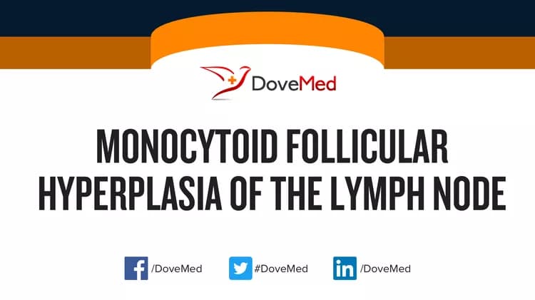 Monocytoid Follicular Hyperplasia of the Lymph Node