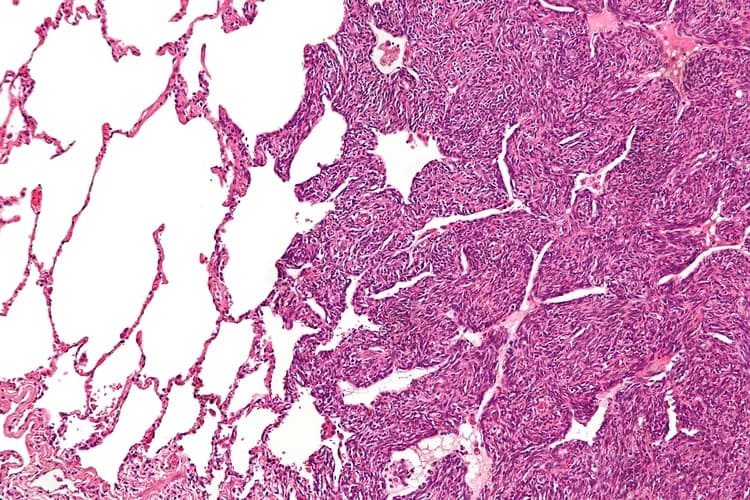 Image by Nephron - Wikicommons