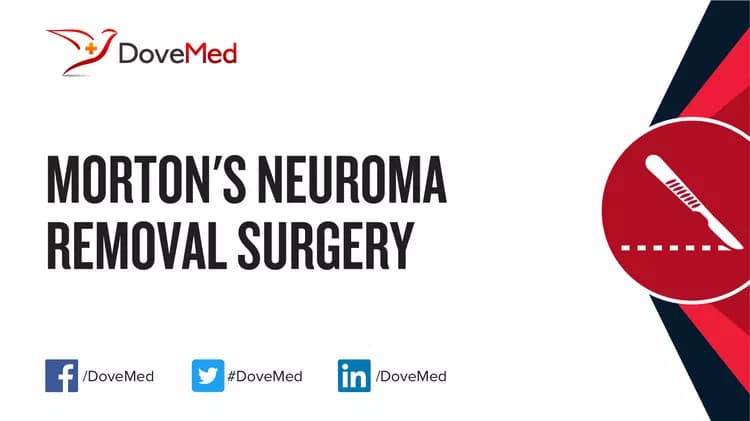 Morton's Neuroma Removal Surgery