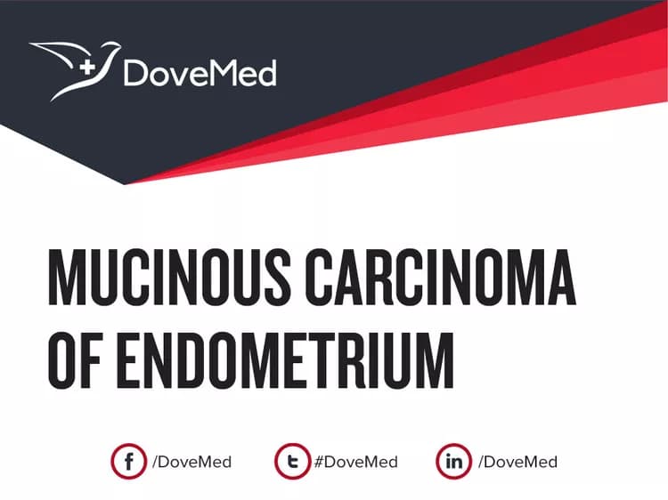 Are you satisfied with the quality of care to manage Mucinous Carcinoma of Endometrium in your community?
