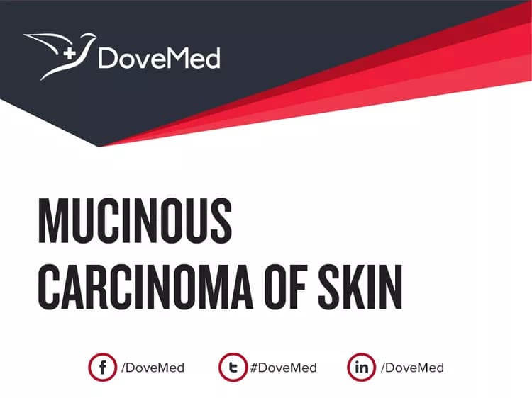 Mucinous Carcinoma of Skin