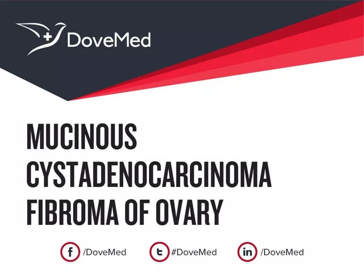 Can you access healthcare professionals in your community to manage Mucinous Cystadenocarcinoma Fibroma of Ovary?