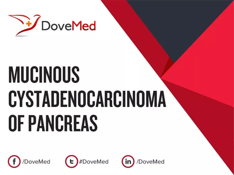 Can you access healthcare professionals in your community to manage Mucinous Cystadenocarcinoma of Pancreas?