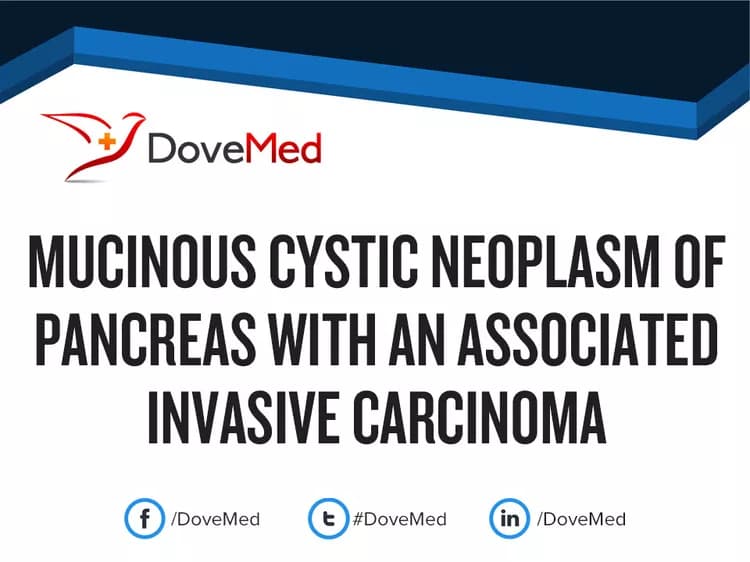 Can you access healthcare professionals in your community to manage Mucinous Cystic Neoplasm of Pancreas?